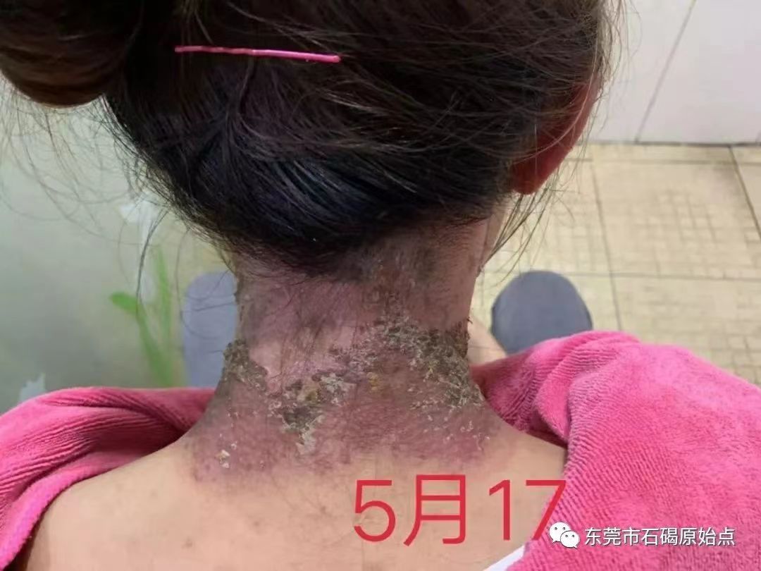 微信图片_20220822170918 微信图片_20220822170918