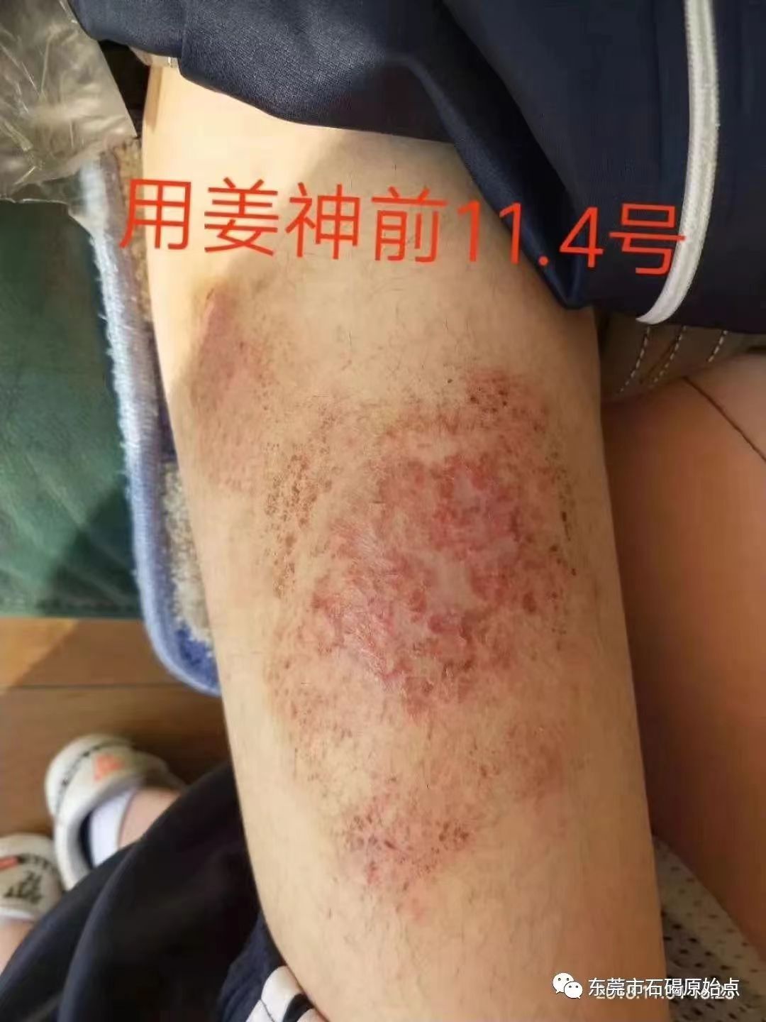 微信图片_20220822173105 微信图片_20220822173105