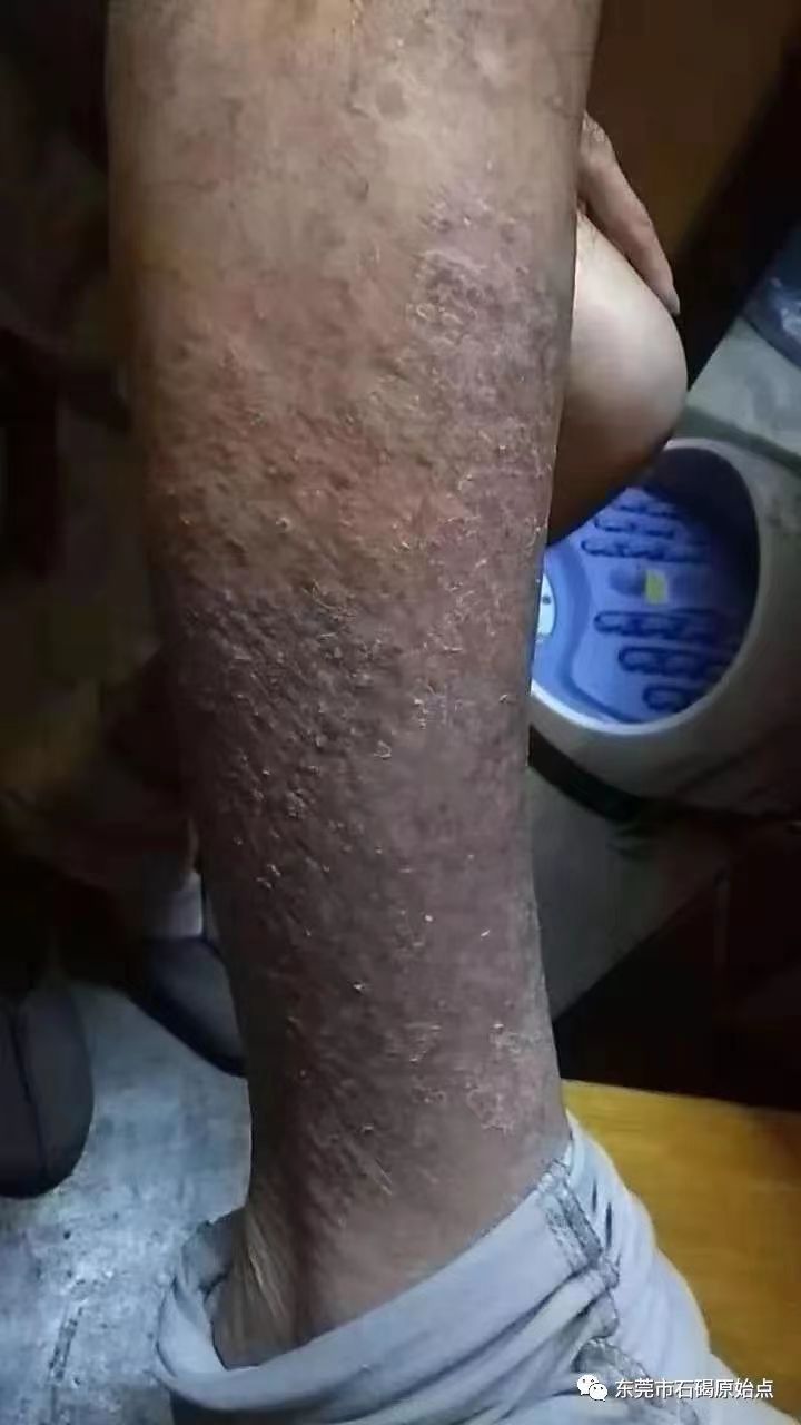 微信图片_20220822171615 微信图片_20220822171615