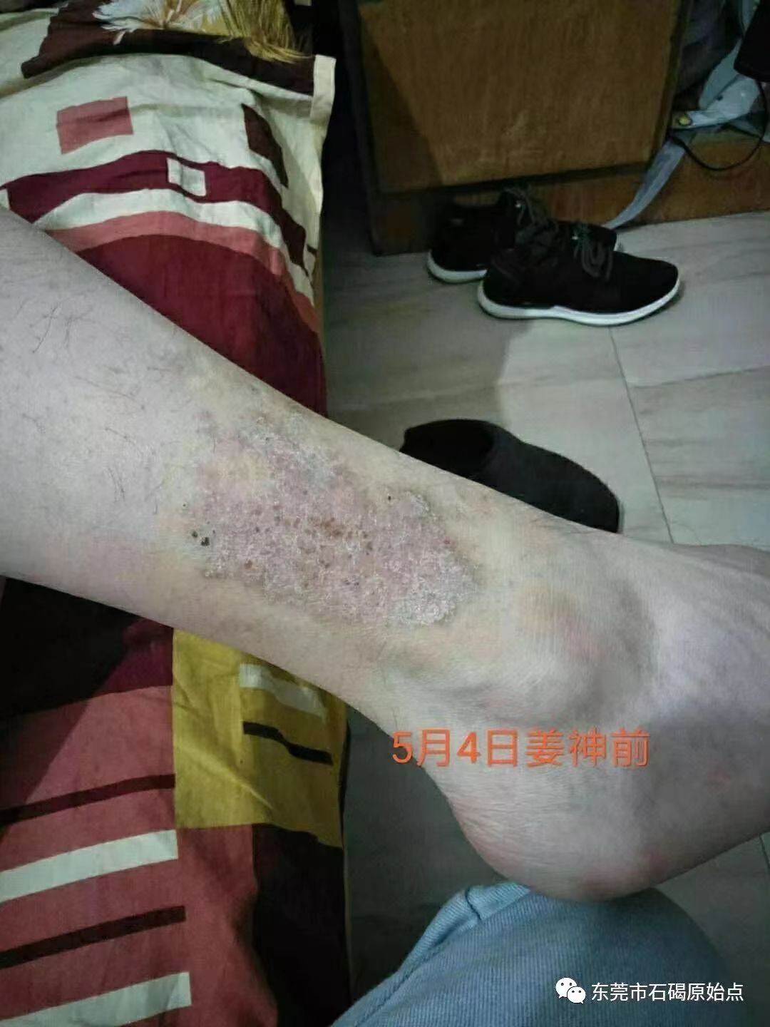 微信图片_20220822171535 微信图片_20220822171535