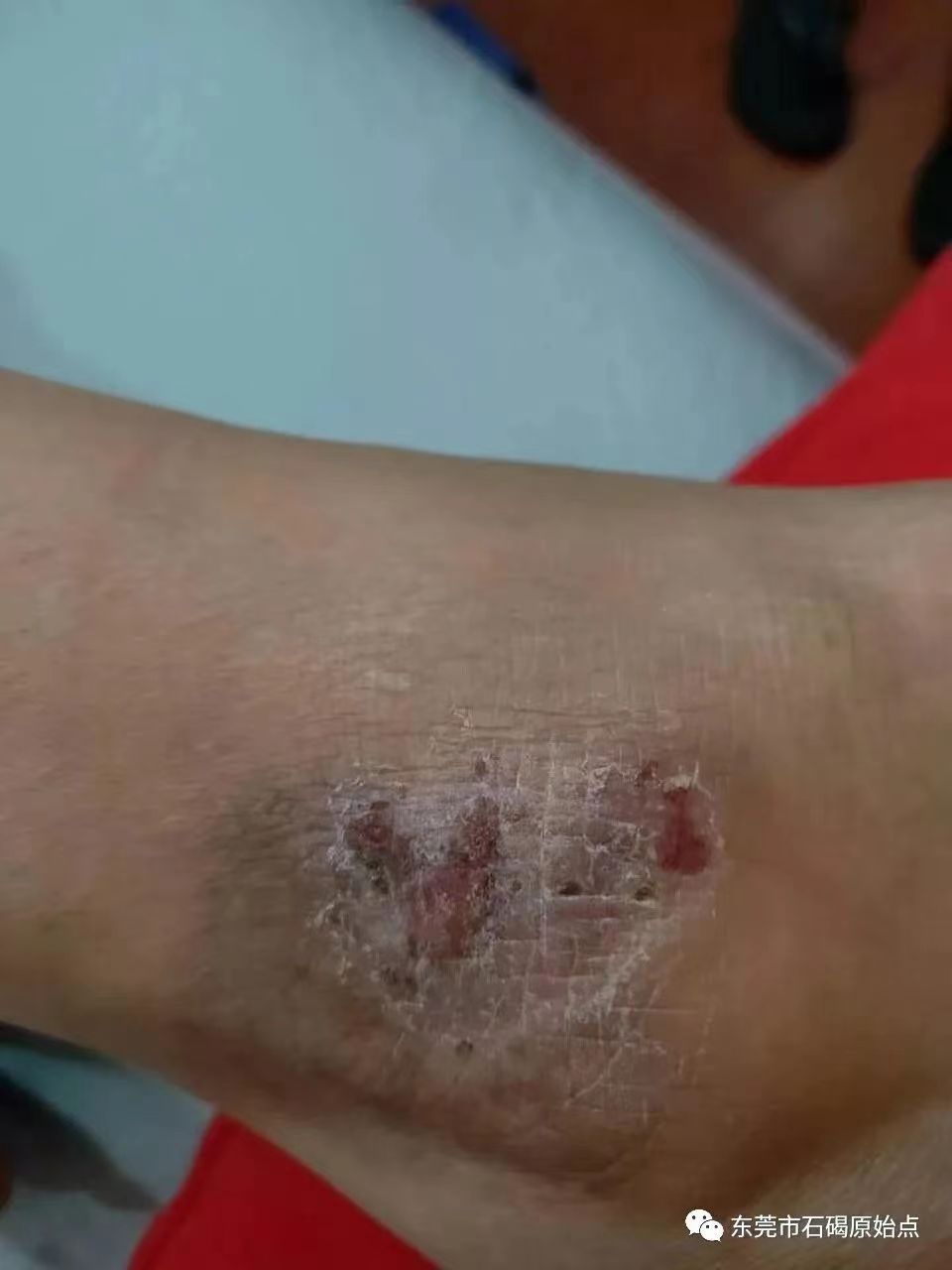 微信图片_20220822171638 微信图片_20220822171638