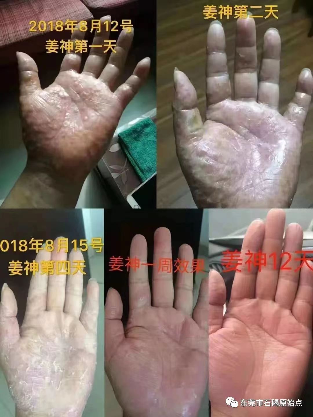 微信图片_20220822172630 微信图片_20220822172630