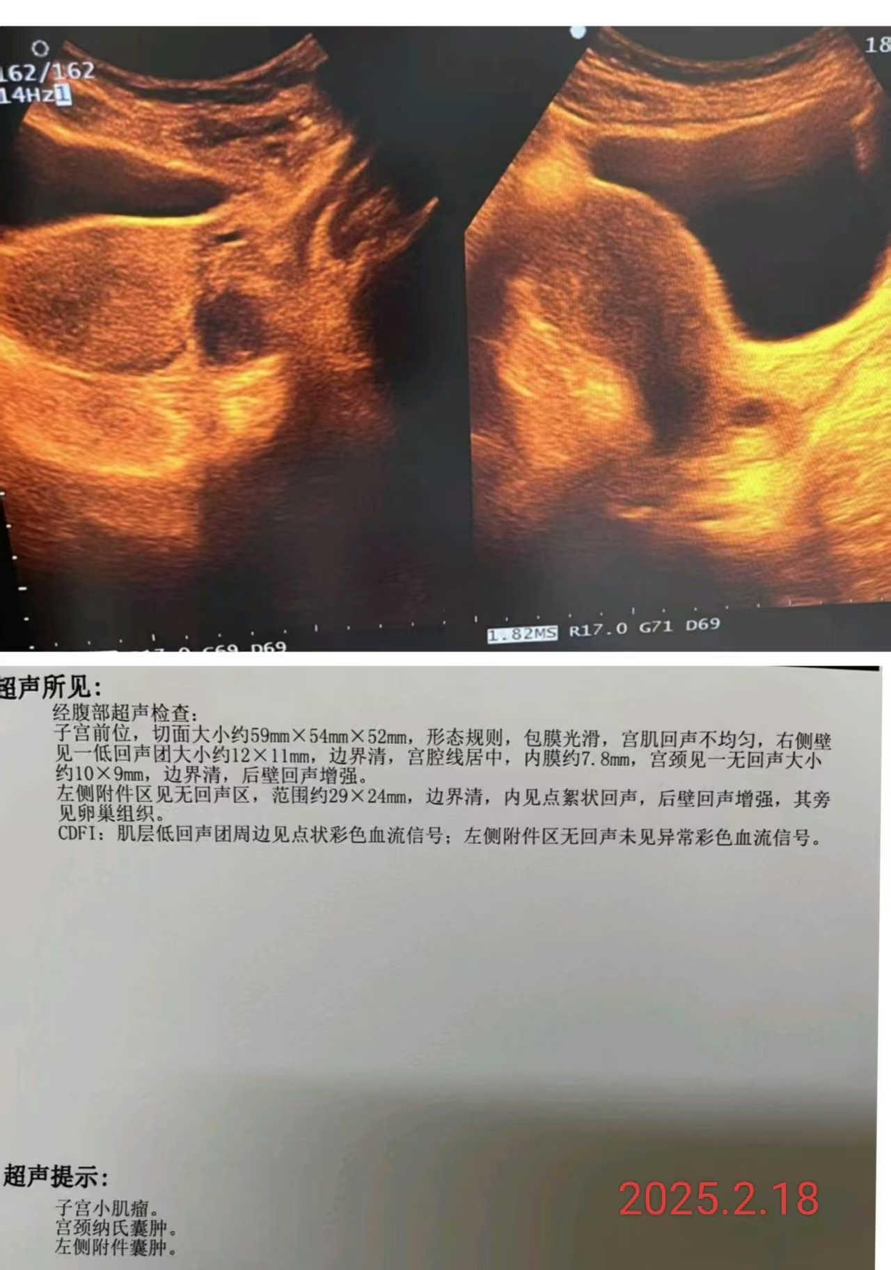 微信图片_20250225180216